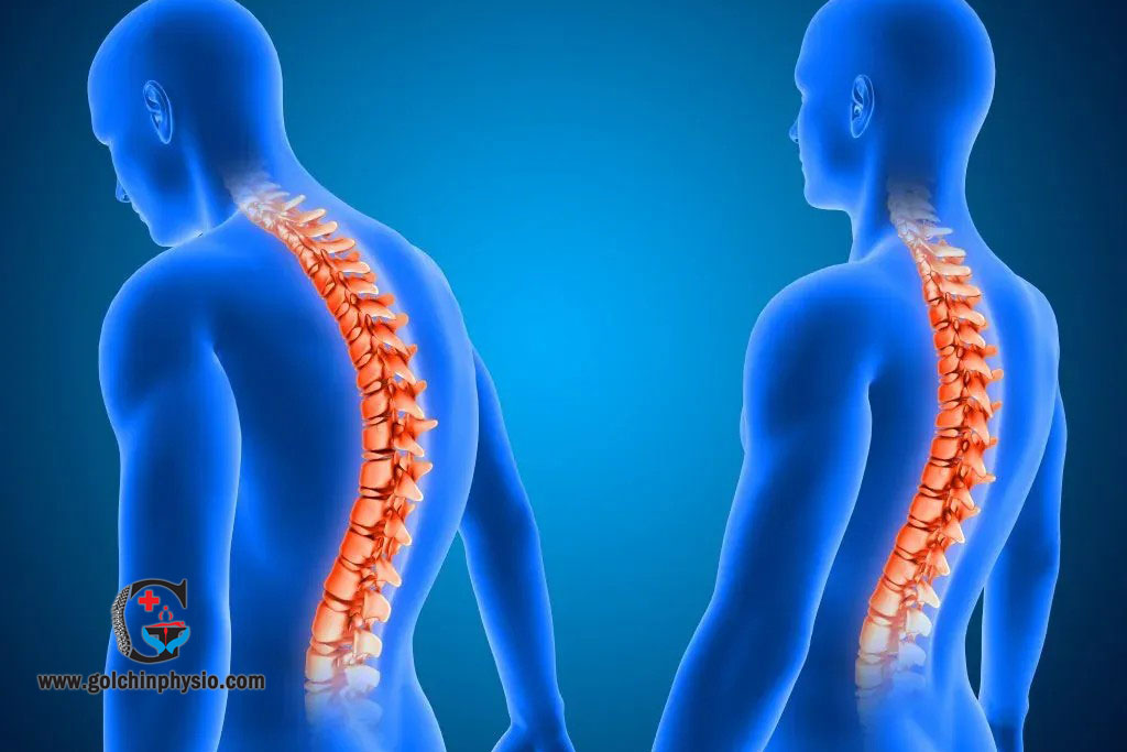 اصلاح ناهنجاری‌های شایع بدنی