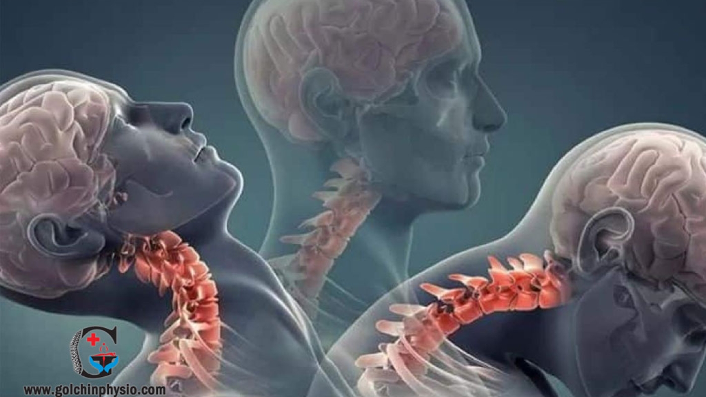 بیماری‌های سیستم عصبی توانبخشی سکته مغزی و ام‌اس (MS) در مرکز فیزیوتراپی گلچین